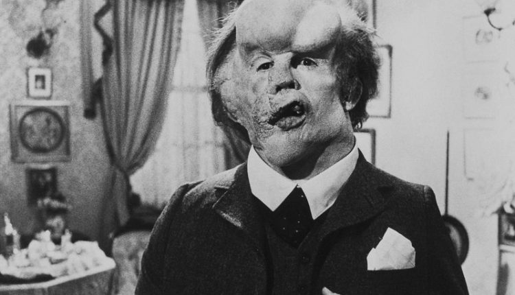 The Elephant Man (1980)